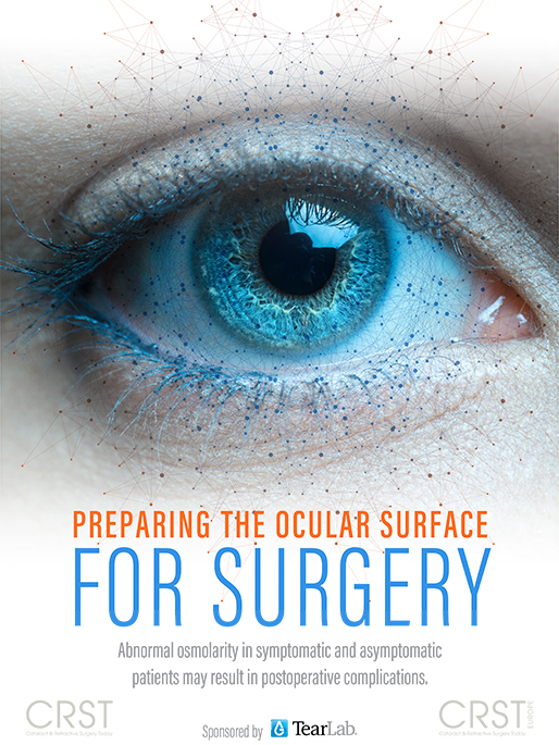 Preparing the Ocular Surface for Surgery