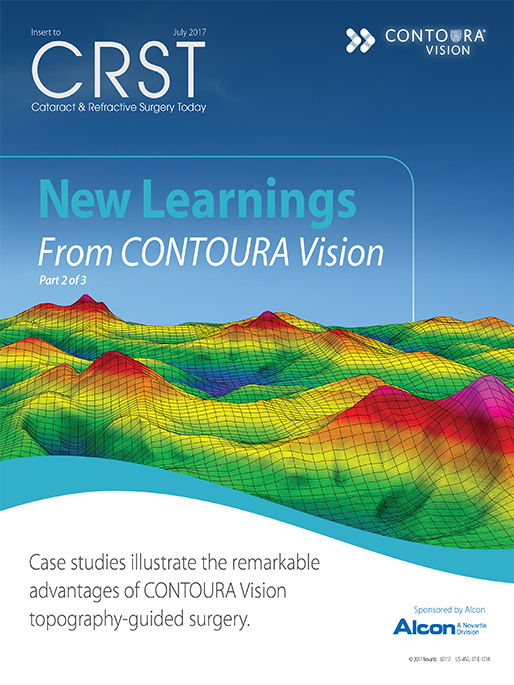 New Learnings From CONTOURA Vision