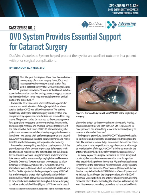 OVD System Provides Essential Support for Cataract Surgery