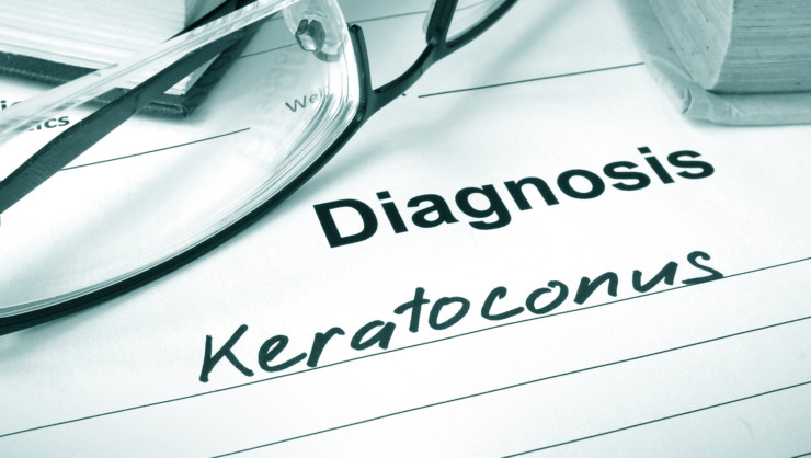 Crstoday Keratoconic Progression After Epithelium On Cxl