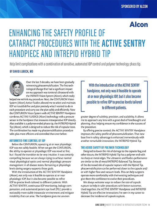 Enhancing the Safety profile of Cataract Procedures With the Active Sentry Handpiece and Intrepid Hybrid Tip