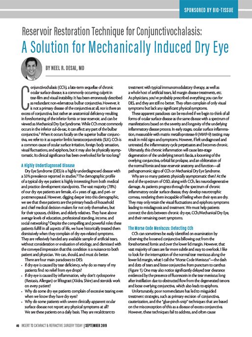 Reservoir Restoration Technique for Conjunctivochalasis: A Solution for Mechanically Induced Dry Eye