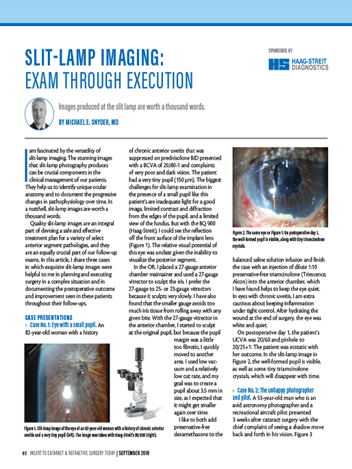 Slit-Lamp Imaging: Exam Through Execution