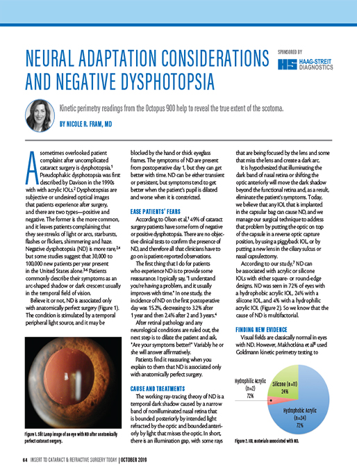 Neural Adaptation Considerations and Negative Dysphotopsia