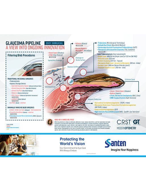 Glaucoma Pipeline Poster