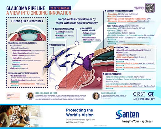 Glaucoma Pipeline: A View Into Ongoing Innovation